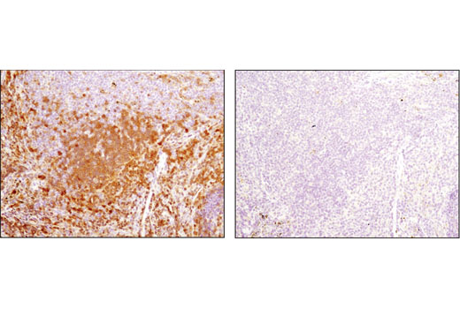 Immunohistochemistry Image 2: Syk (D3Z1E) XP® Rabbit mAb (BSA and Azide Free)