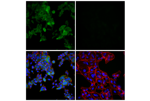 Immunofluorescence Image 1: Syk (D3Z1E) XP® Rabbit mAb (BSA and Azide Free)