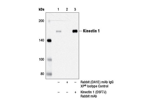 Immunoprecipitation Image 1: Kinectin 1 (D5F7J) Rabbit mAb