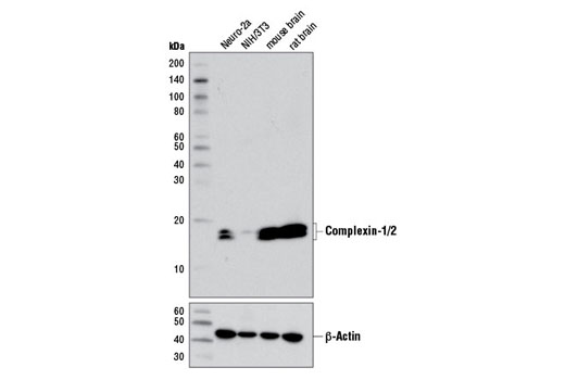 Western Blotting Image 1: Complexin-1/2 Antibody
