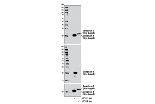 Western Blotting Image 2: Complexin-1/2 Antibody