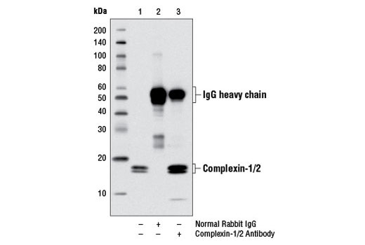 Immunoprecipitation Image 1: Complexin-1/2 Antibody