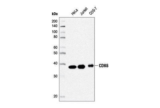  Image 7: CDK Antibody Sampler Kit