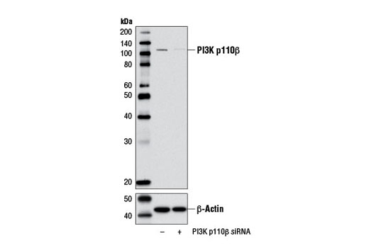  Image 1: SignalSilence® PI3 Kinase p110β siRNA I