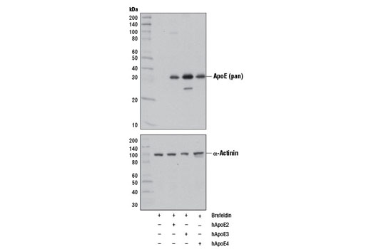  Image 17: ApoE Synaptic Formation and Signaling Pathway Antibody Sampler Kit