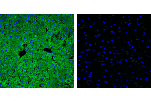 Immunofluorescence Image 1: FABP1 (D2A3X) XP® Rabbit mAb