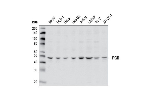 Western Blotting Image 1: PGD Antibody