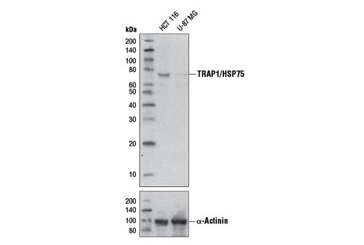 Western Blotting Image 1: TRAP1/HSP75 Antibody