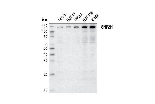 Western Blotting Image 1: SNF2H Antibody