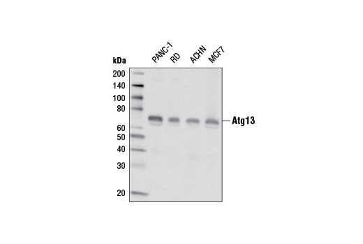  Image 1: PhosphoPlus® Atg13 (Ser355) Antibody Duet