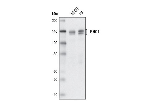 Western Blotting Image 1: PHC1 Antibody