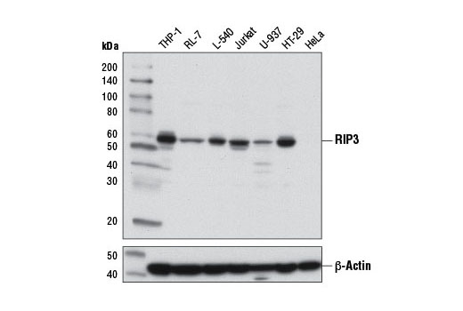  Image 1: PhosphoPlus® RIP3 (Ser227) Antibody Duet
