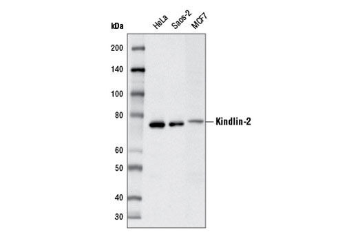 Western Blotting Image 1: Kindlin-2 Antibody