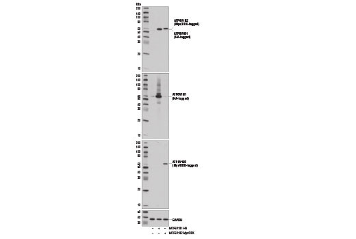 Western Blotting Image 2: ATP6V1B1/2 Antibody