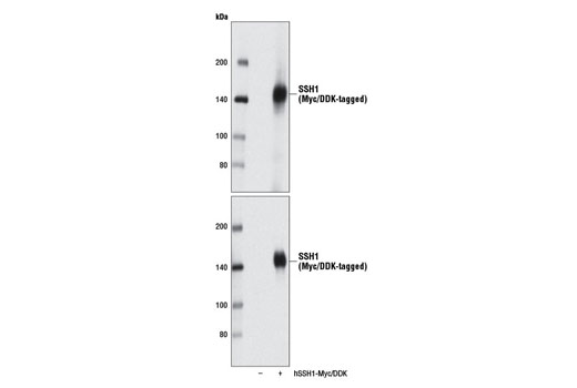  Image 11: Cofilin Activation Antibody Sampler Kit
