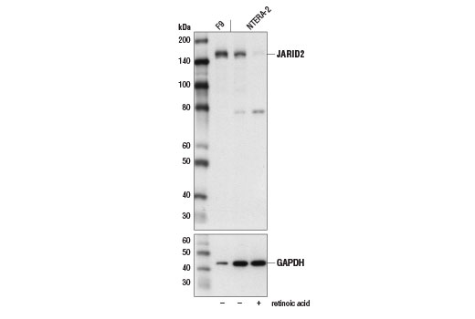  Image 3: Polycomb Group 2 (PRC2) Antibody Sampler Kit
