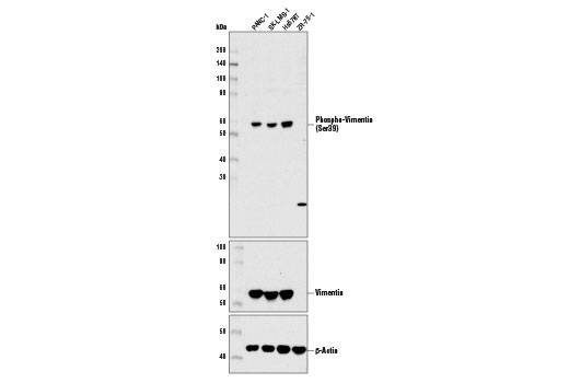 Western Blotting Image 1: Phospho-Vimentin (Ser39) Antibody