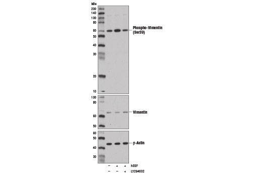 Western Blotting Image 3: Phospho-Vimentin (Ser39) Antibody