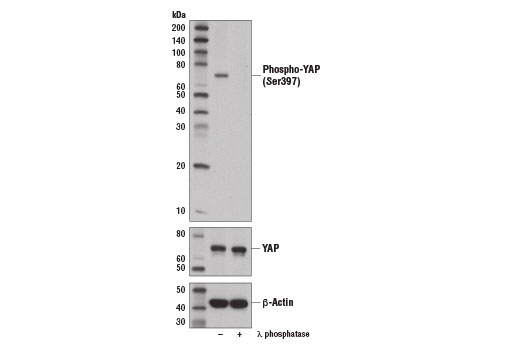  Image 8: Phospho-YAP/TAZ Antibody Sampler Kit