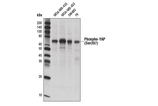  Image 23: Phospho-YAP/TAZ Antibody Sampler Kit