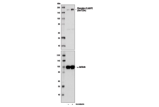 Western Blotting Image 1: Phospho-CLASP2 (Ser1234) Antibody