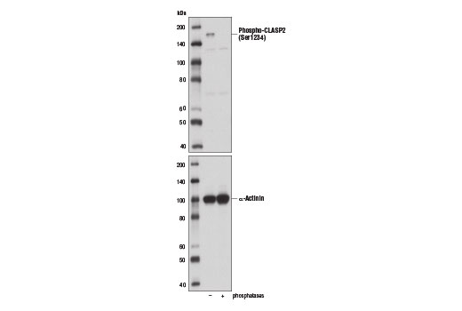 Western Blotting Image 2: Phospho-CLASP2 (Ser1234) Antibody