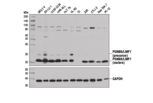  Image 7: MHC Class I Antigen Processing and Presentation Antibody Sampler Kit