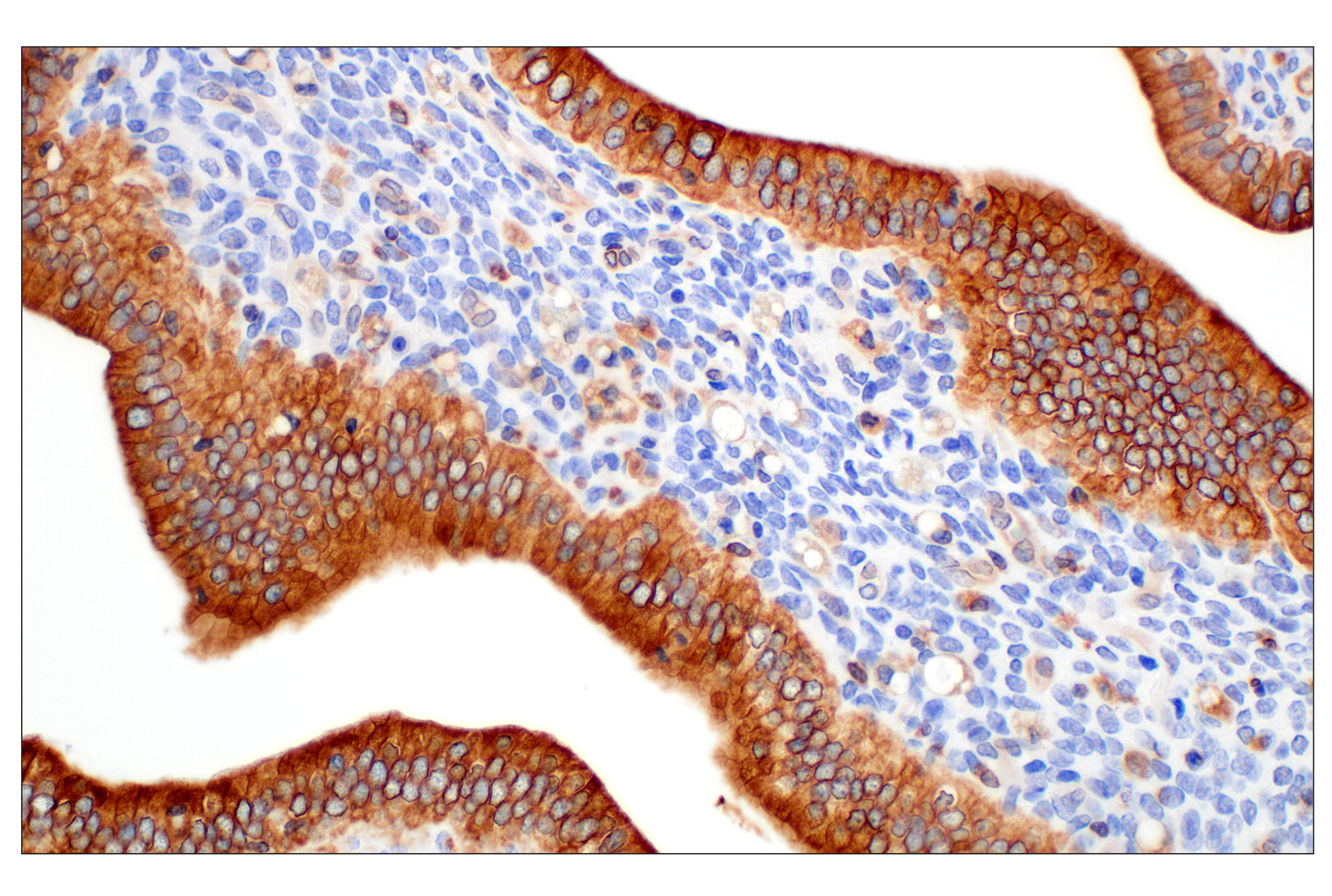 Immunohistochemistry Image 9: STING (D2P2F) Rabbit mAb