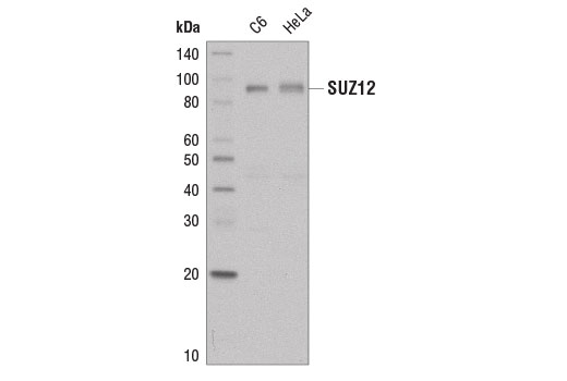 Western Blotting Image 1: SUZ12 (D39F6) XP® Rabbit mAb (Biotinylated)