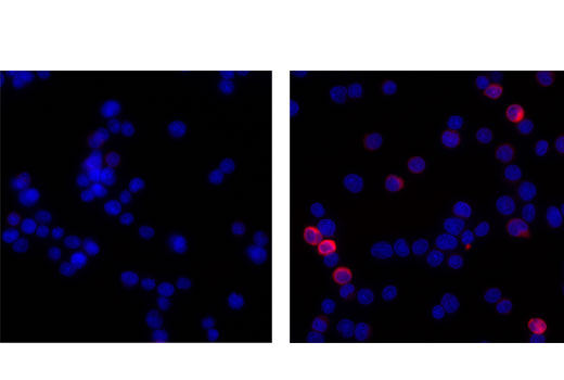 Immunofluorescence Image 1: Phospho-HS1 (Tyr378/397) (D12C1) XP® Rabbit mAb (Alexa Fluor® 647 Conjugate)