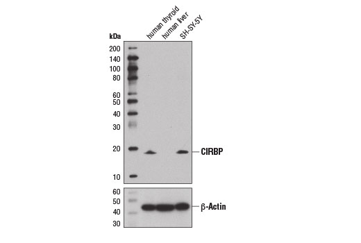 Western Blotting Image 1: CIRBP Antibody