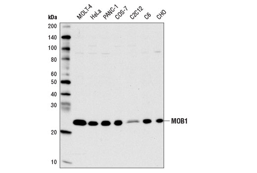  Image 1: PhosphoPlus® MOB1A/MOB1B (Thr35) Antibody Duet