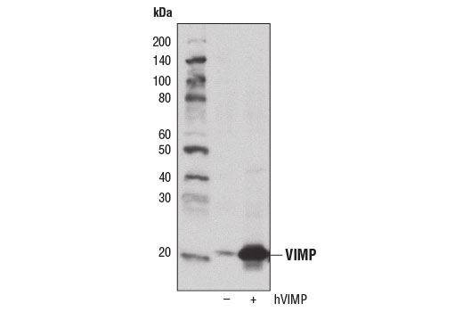 Western Blotting Image 2: VIMP Antibody