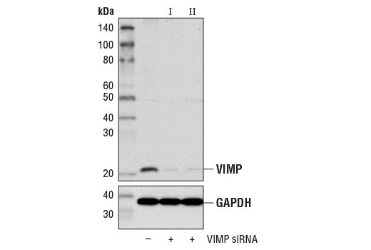 Western Blotting Image 3: VIMP Antibody