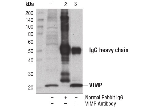 Immunoprecipitation Image 1: VIMP Antibody