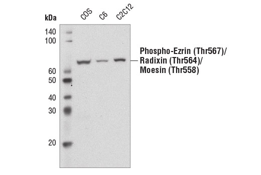 Western Blotting Image 1: Phospho-Ezrin (Thr567)/Radixin (Thr564)/Moesin (Thr558) (41A3) Rabbit mAb (Biotinylated)