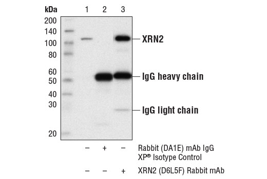 Immunoprecipitation Image 1: XRN2 (D6L5F) Rabbit mAb
