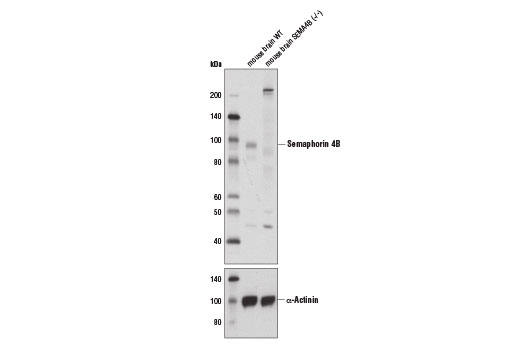 Western Blotting Image 1: Semaphorin 4B Antibody