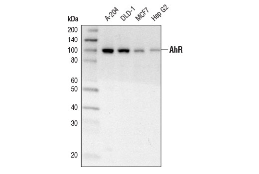 Western Blotting Image 1: AhR Antibody