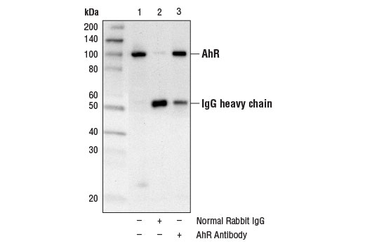 Immunoprecipitation Image 1: AhR Antibody