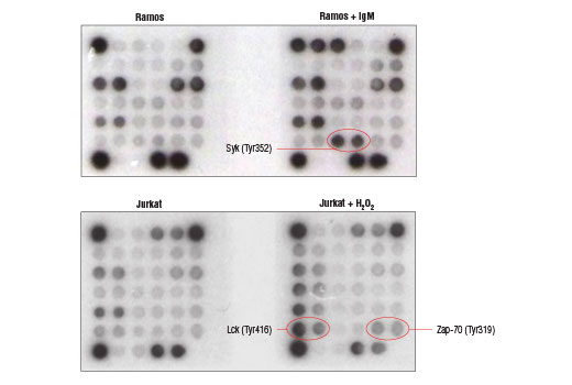  Image 2: PathScan® Immune Cell Signaling Antibody Array Kit (Chemiluminescent Readout)