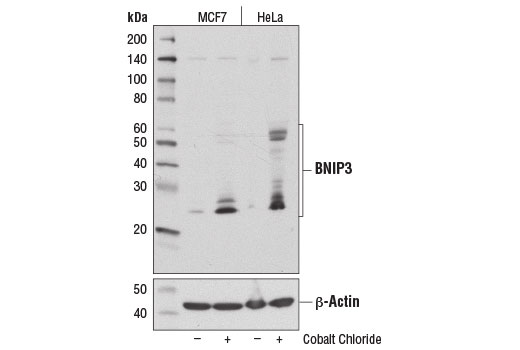 Western Blotting Image 1: BNIP3 Antibody