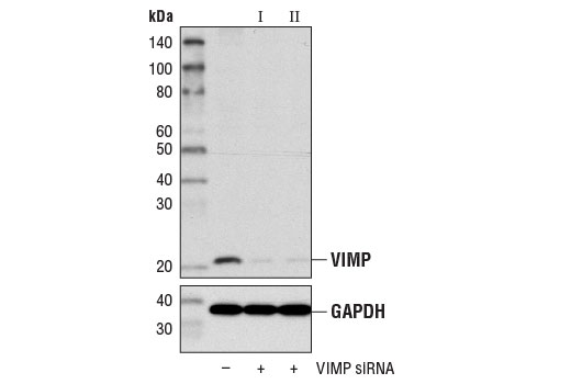  Image 1: SignalSilence® VIMP siRNA I