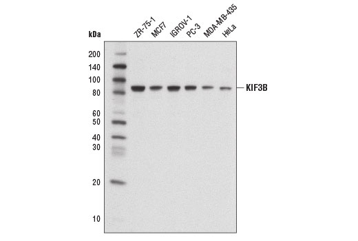 Western Blotting Image 1: KIF3B Antibody