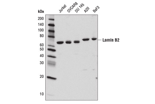 Western Blotting Image 1: Lamin B2 (E1S1Q) Rabbit mAb