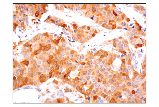  Image 24: Human Reactive Inflammasome Antibody Sampler Kit II