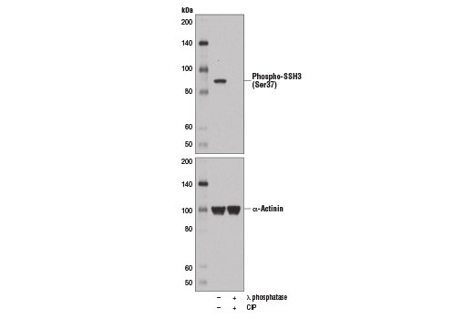 Western Blotting Image 1: Phospho-SSH3 (Ser37) Antibody