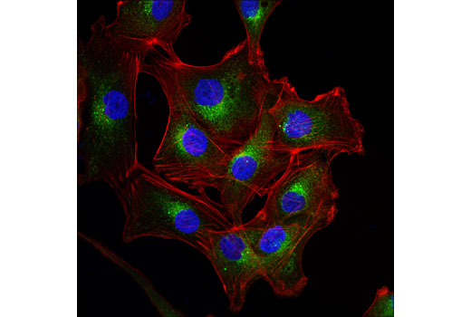 Immunofluorescence Image 1: VAMP7 (D8Y1R) Rabbit mAb (IF Specific)