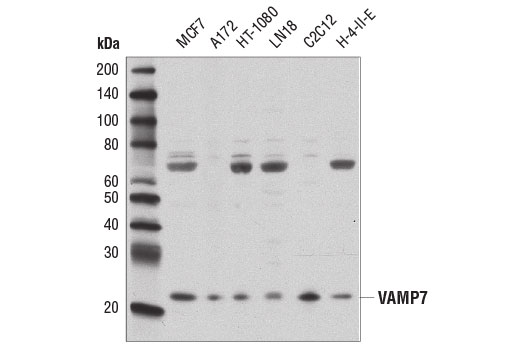 Western Blotting Image 2: VAMP7 Antibody