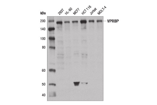 Western Blotting Image 1: VPRBP Antibody